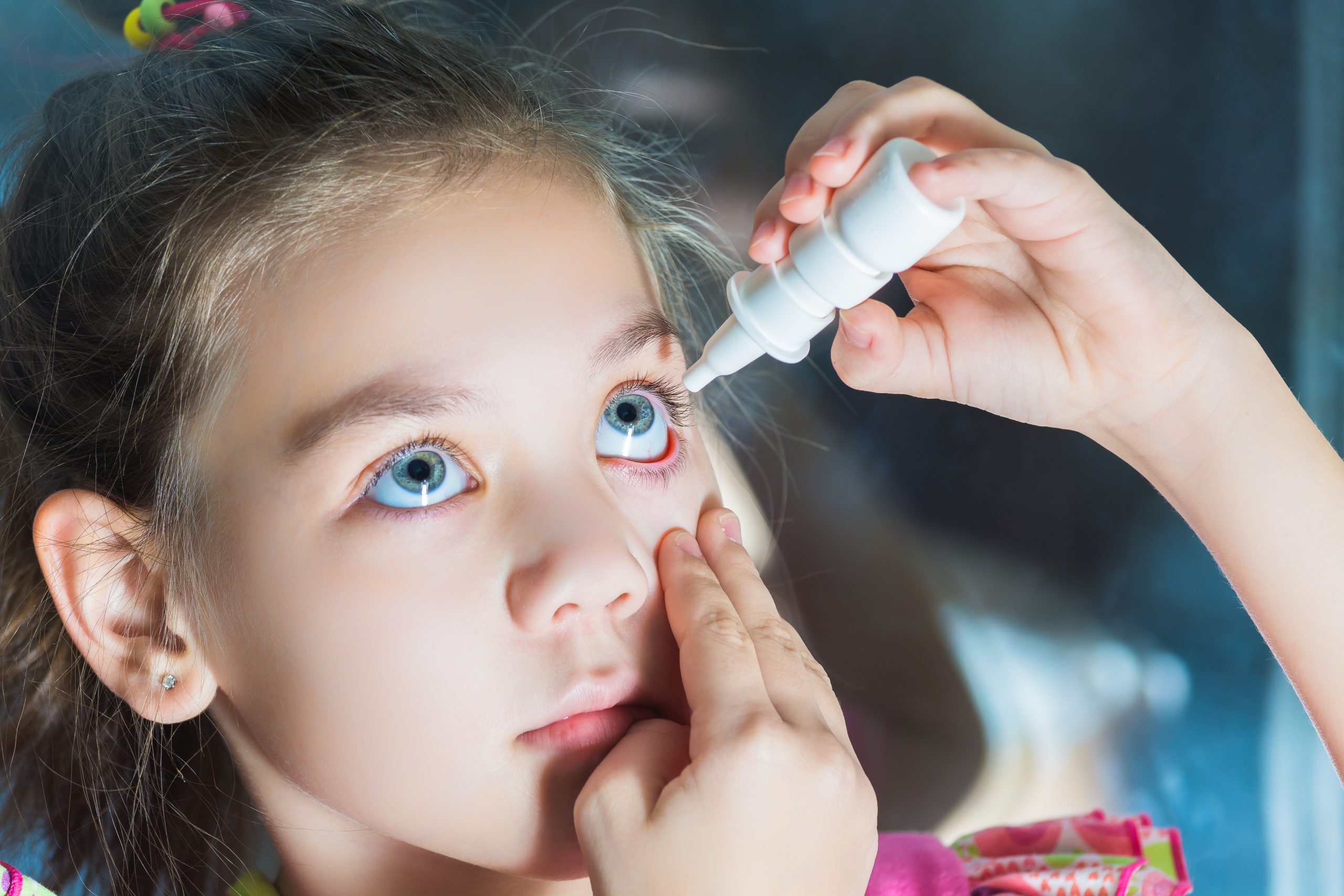 how-to-treat-your-child-s-eye-infection-gulf-coast-vision-center